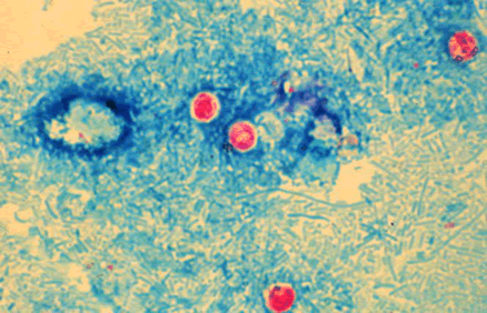 cryptosporidium-2